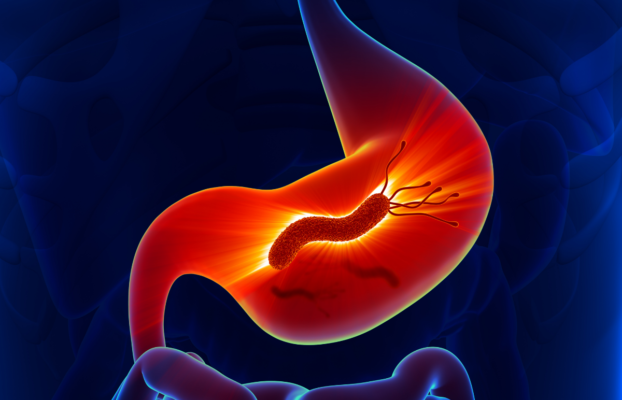 Helicobacter Pylori: Qué es, síntomas y cómo se detecta en Panamá