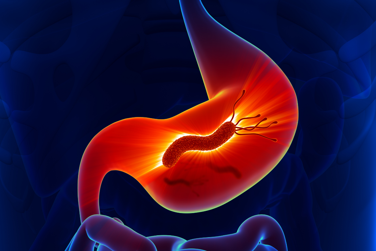 Helicobacter Pylori: What It Is, Symptoms, and How It Is Detected in Panama