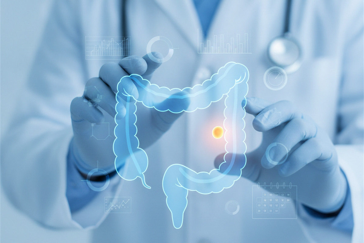 Cáncer de colon: ¿a qué edad debes hacerte la primera colonoscopía?