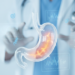 Ilustración del estómago humano con la mucosa inflamada, representando gastritis